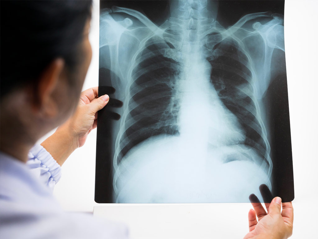 Diagnostica per immagini Thumb